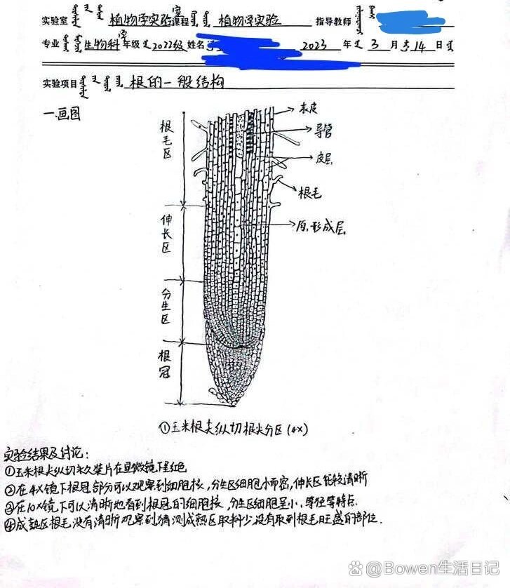 根尖的结构简图图片