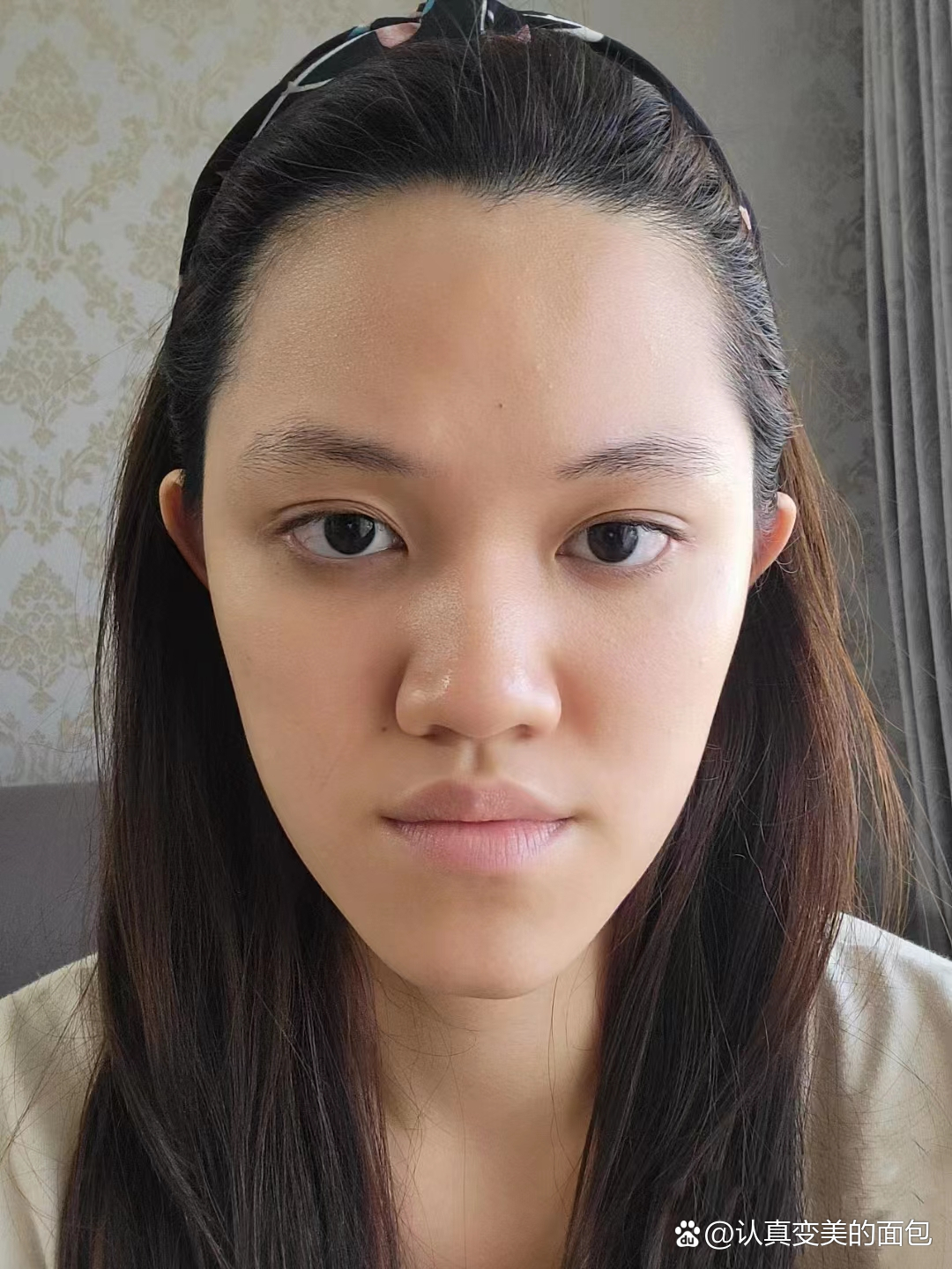 推荐做下巴过长手术整容吗?