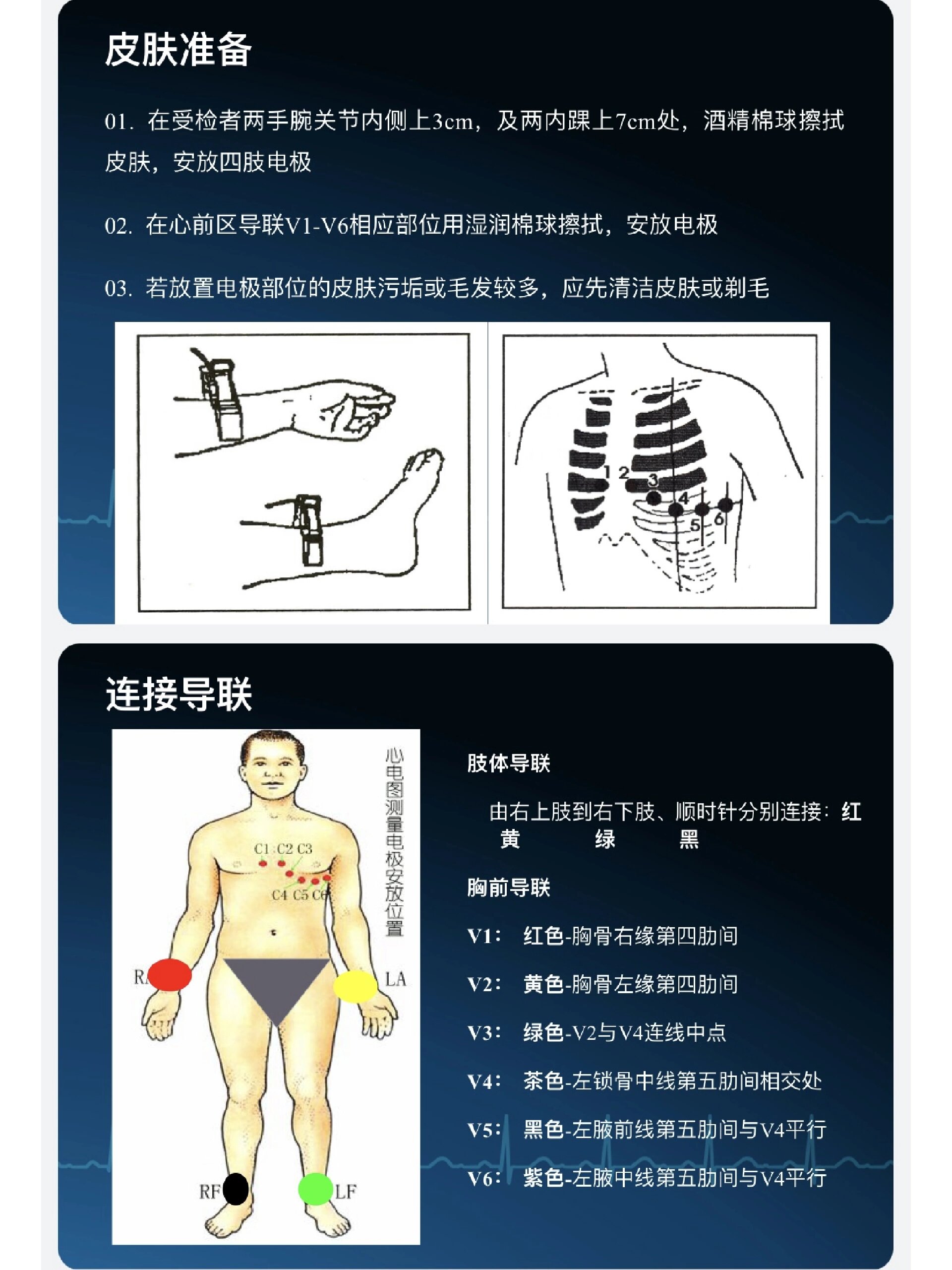 怎么做心电图步骤图片图片