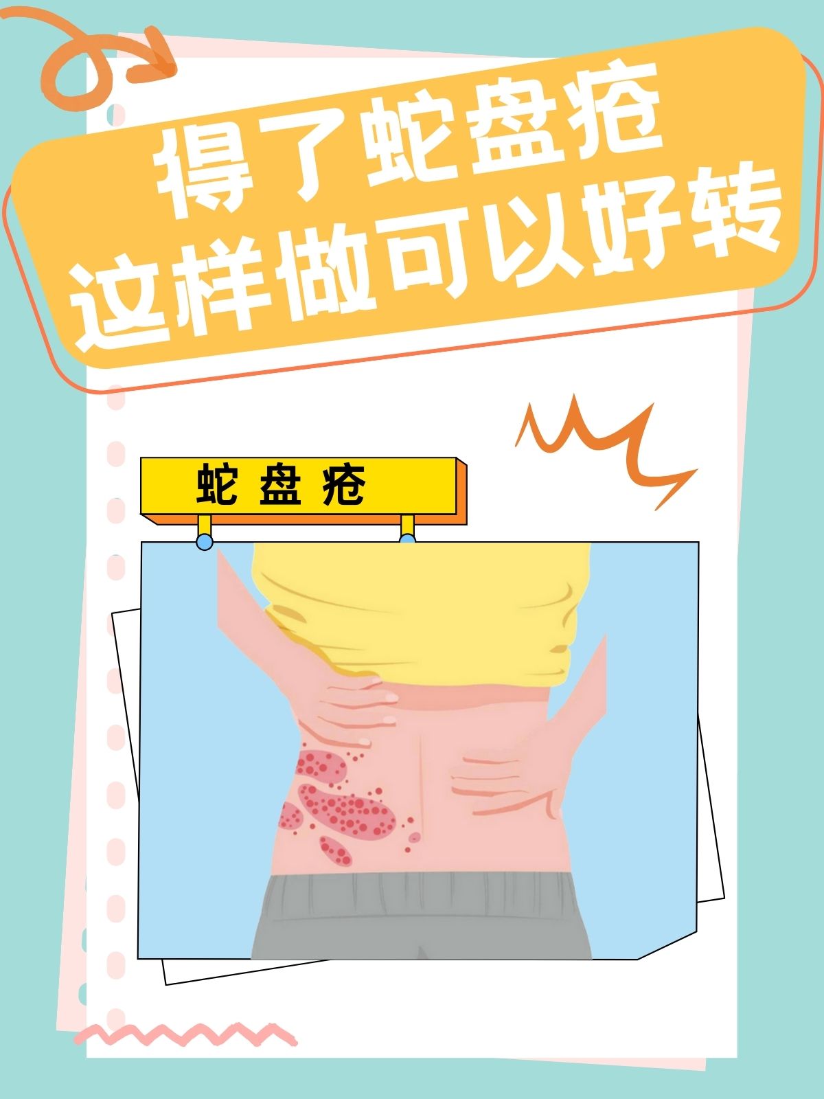 得了蛇盘疮?这样做可以好转