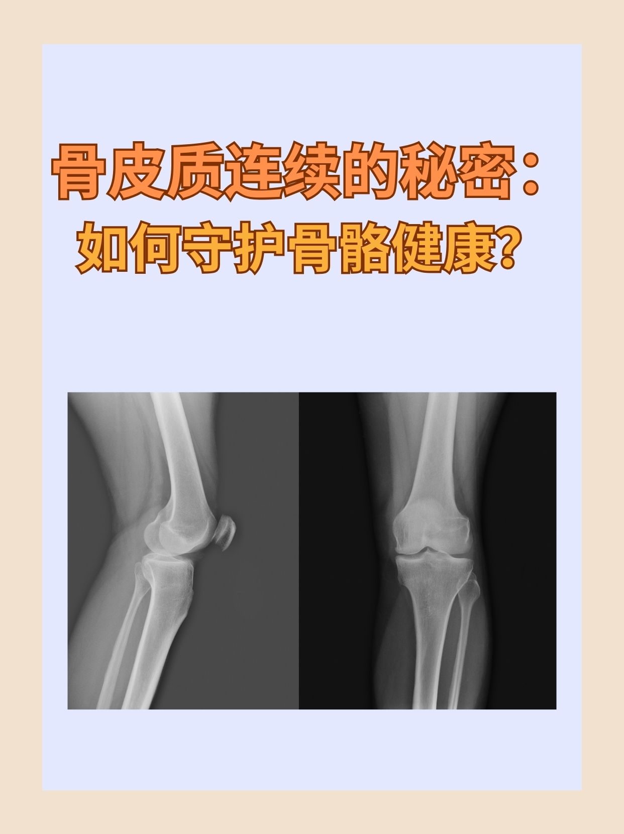 骨皮质连续的秘密:如何守护骨骼健康?