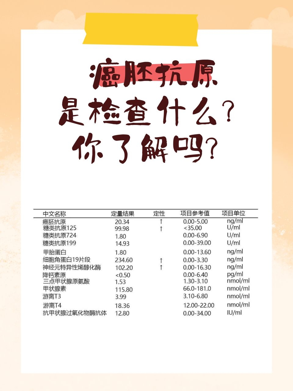 癌胚抗原是检查什么?你了解吗?