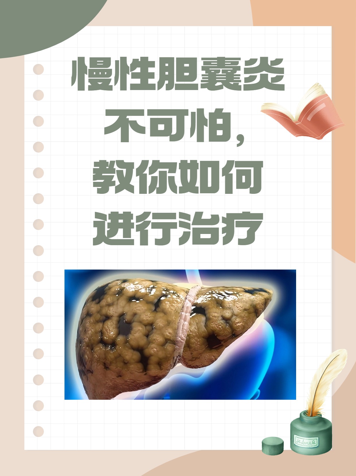 慢性胆囊炎不可怕