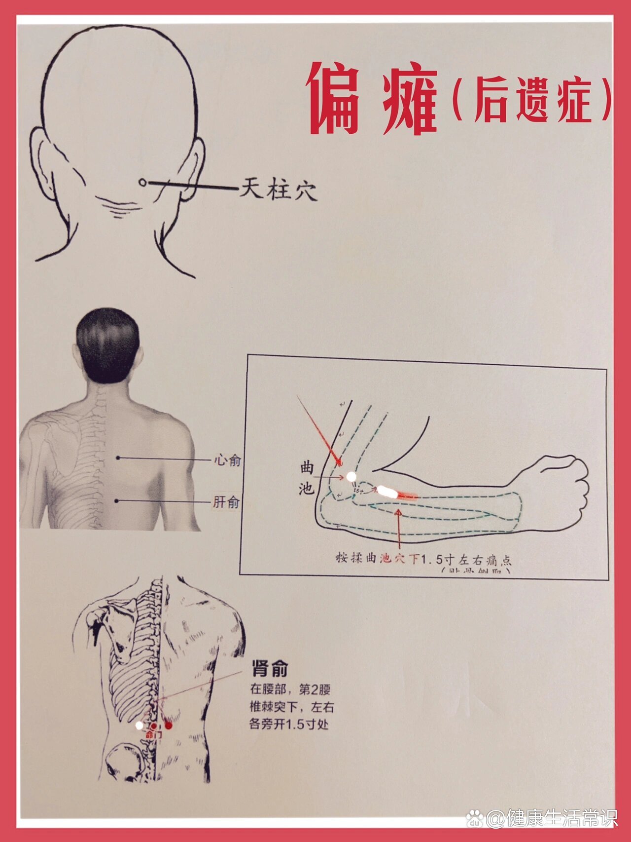 脑梗艾灸哪个部位图图片