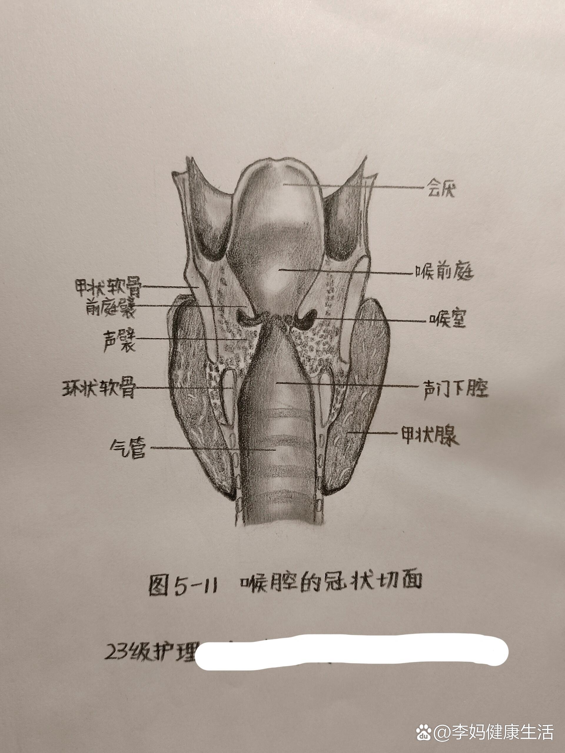 冠状切面图片