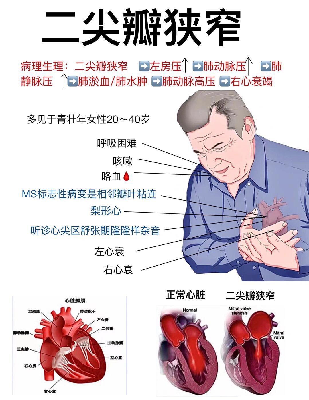 92医学笔记