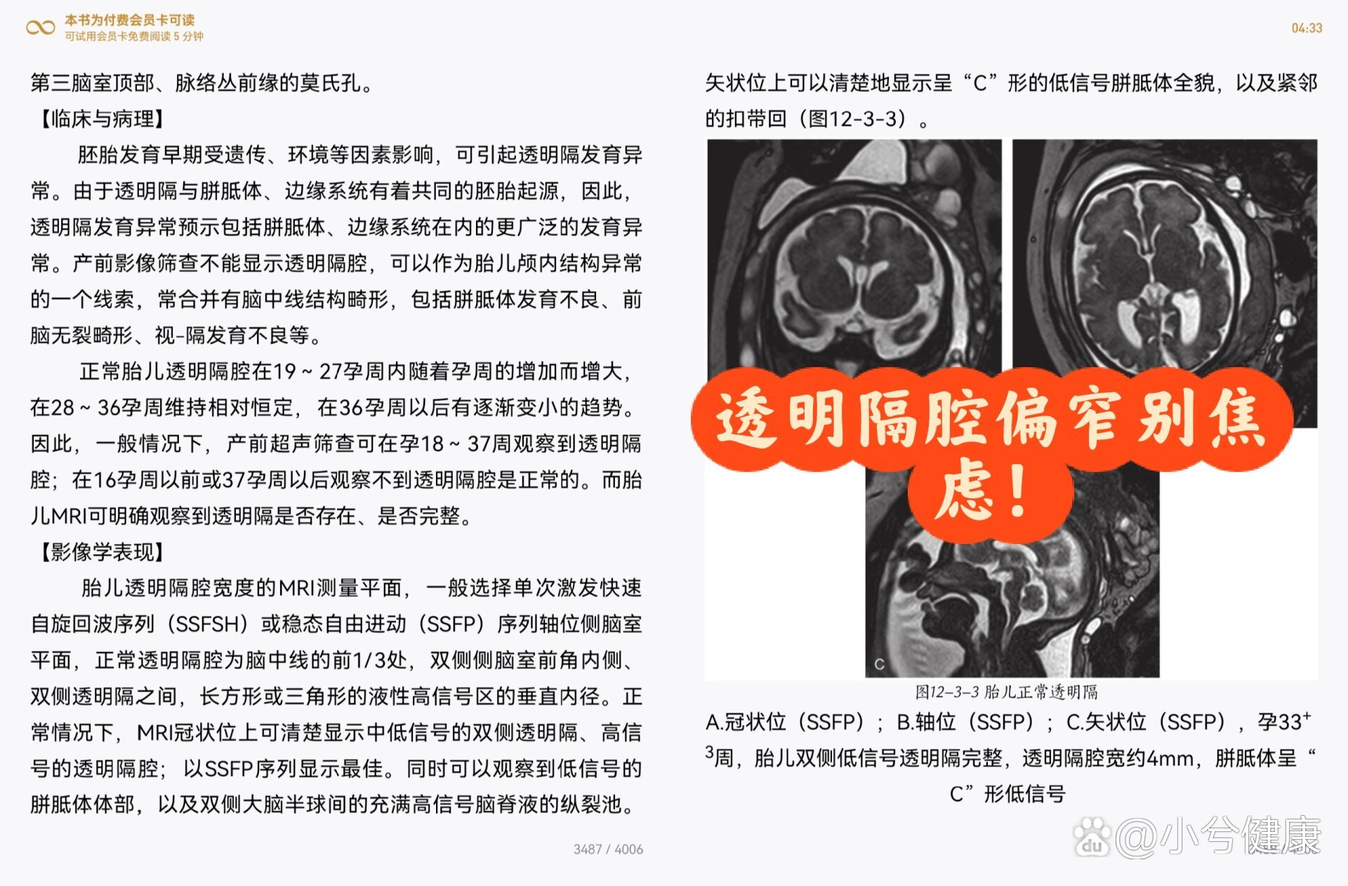 生活︱胎儿透明隔腔问题别焦虑