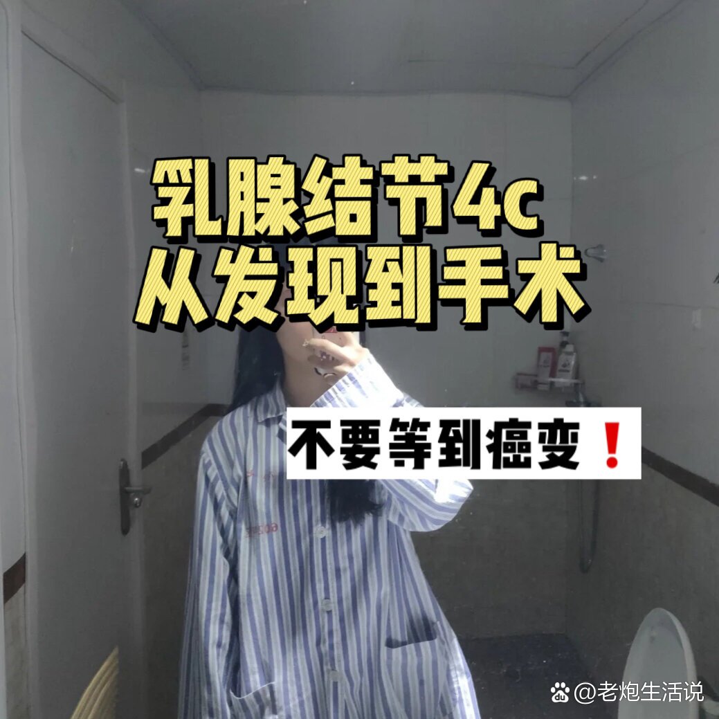 乳腺结节4c图片