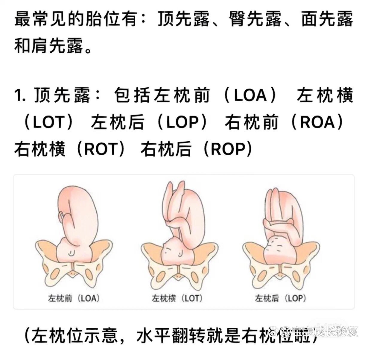 96史上最全胎位名称