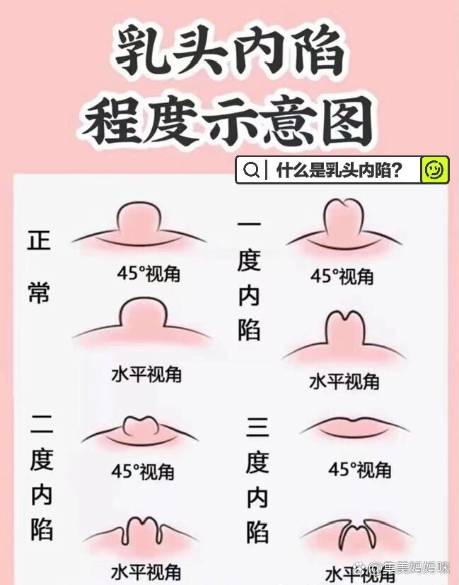 正常乳头女性 大小图片