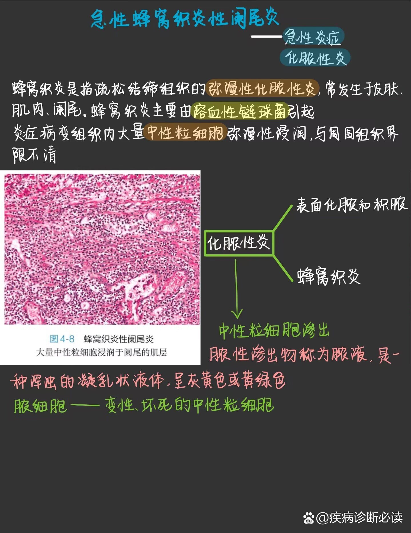 阑尾炎病理生理图图片