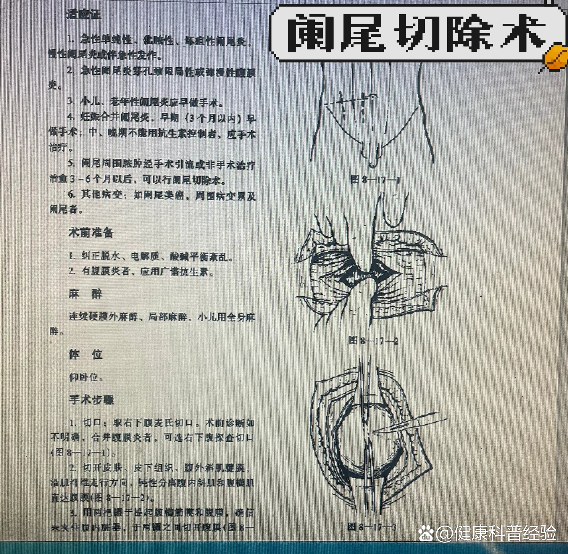 麦氏点定位图图片