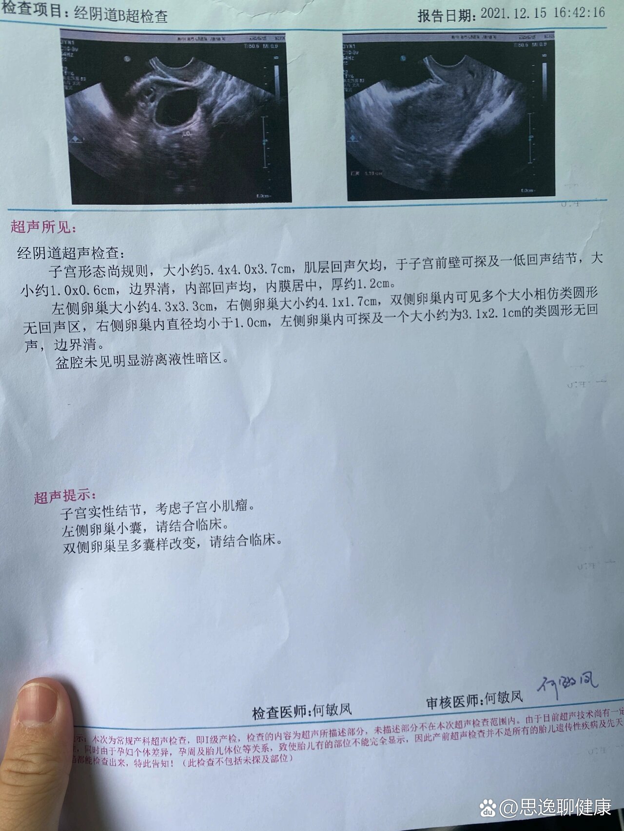卵泡排除后有什么症状(卵泡排除后多久之内同房可以怀孕)