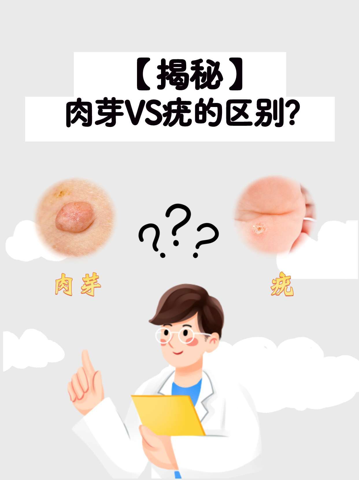 "肉芽还是疣"?一招教你区分!