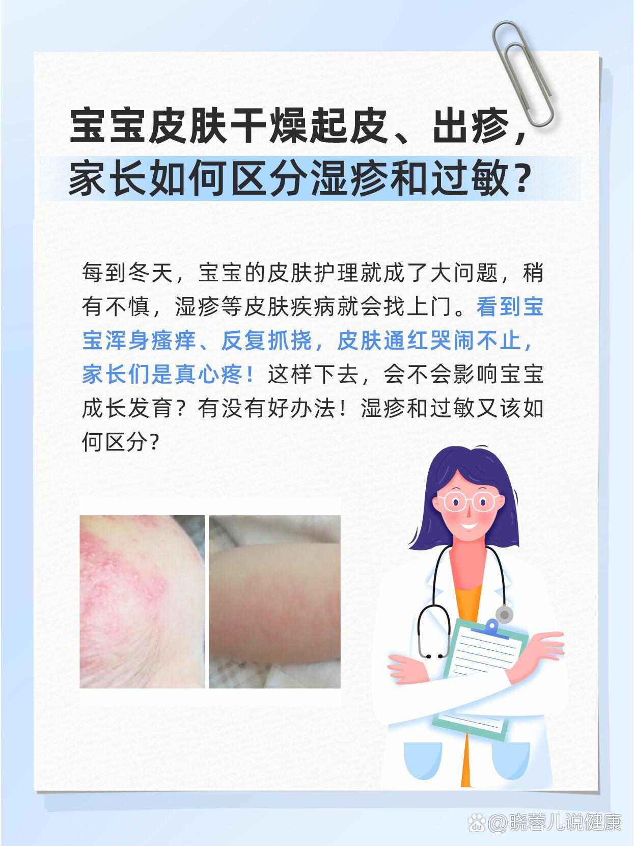 宝宝皮肤起皮,出疹,如何区分湿疹和过敏?