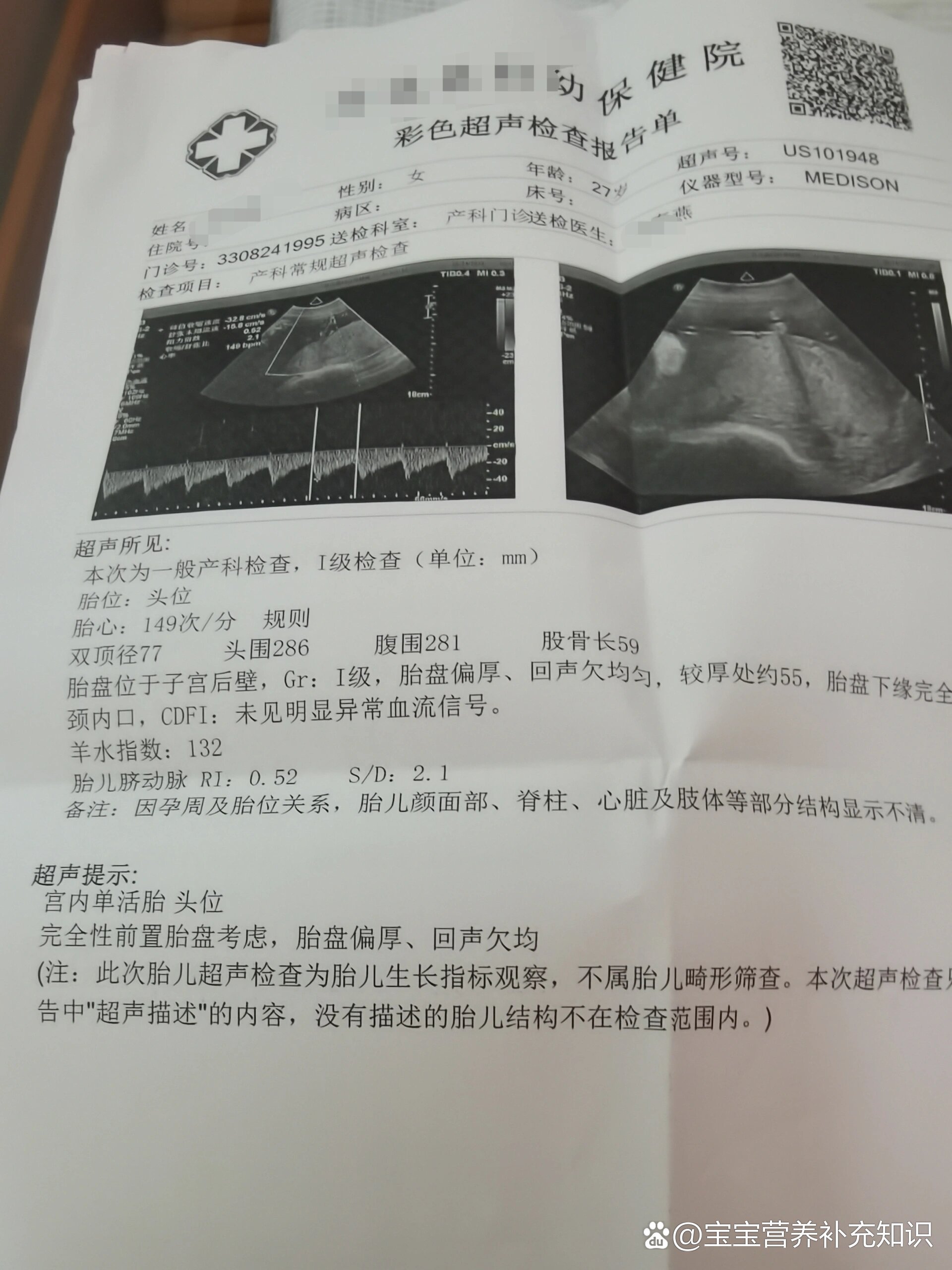 完全性前置胎盘图片图片