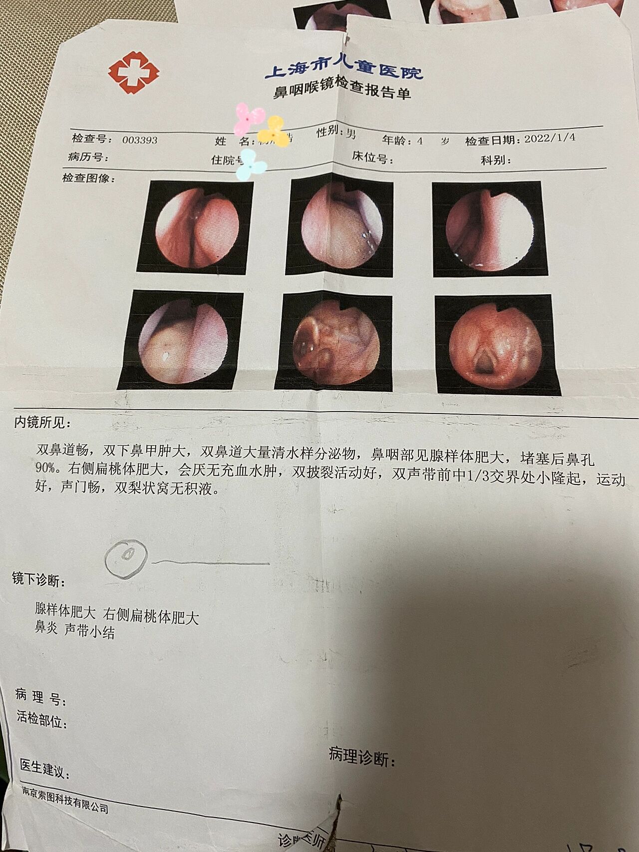 中国人民解放军第八十五医院代挂号口碑高效率快的简单介绍