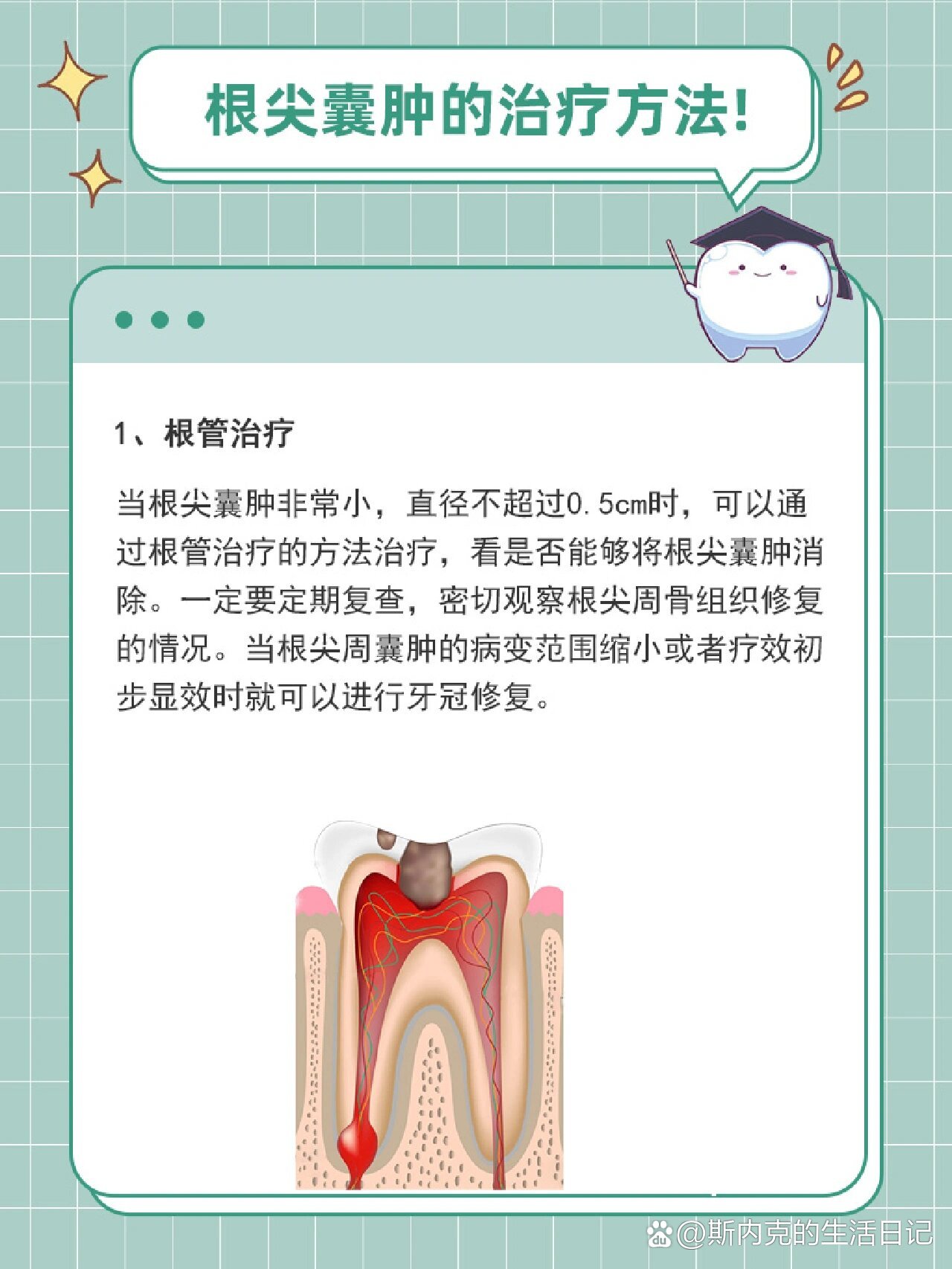 根尖囊肿的治疗方法有哪些71