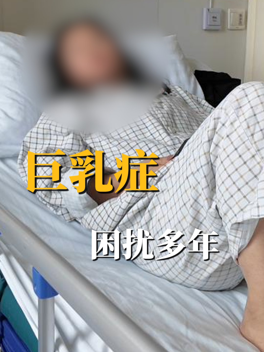 巨乳症 巨乳症困扰多年，对生活很有影响领航计划