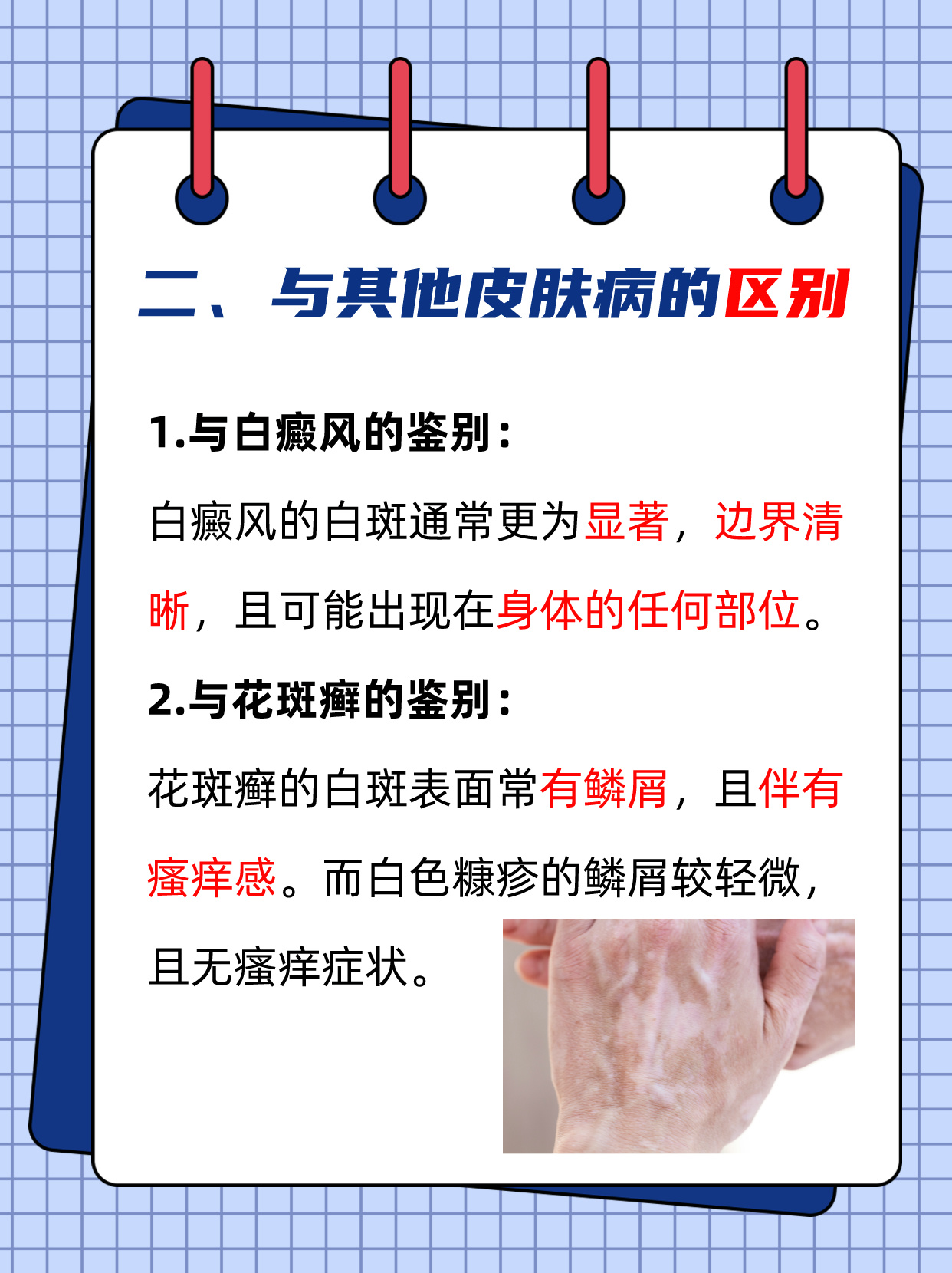 白色糠疹的诊断与鉴别.