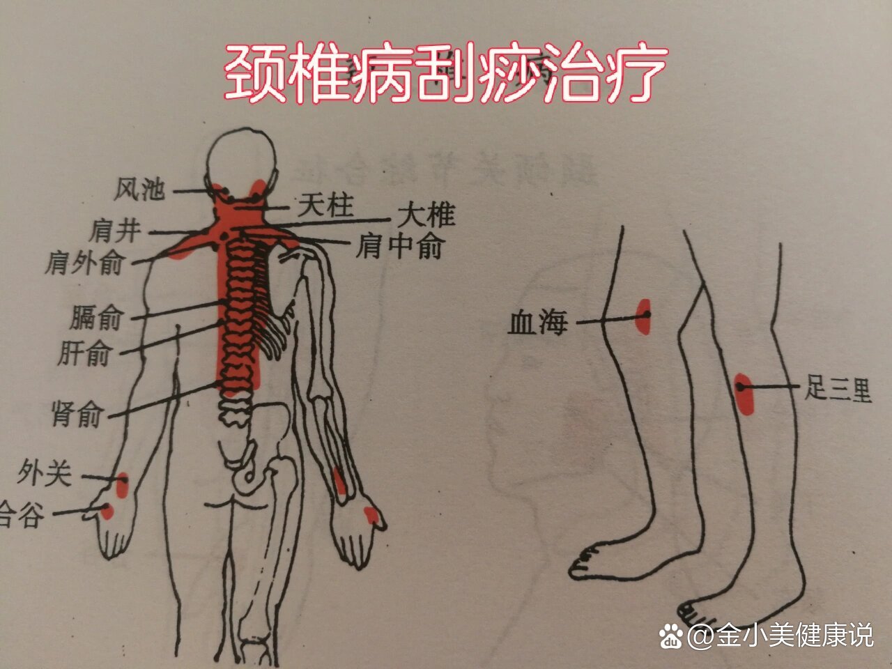 颈椎疼刮痧刮哪里图解图片