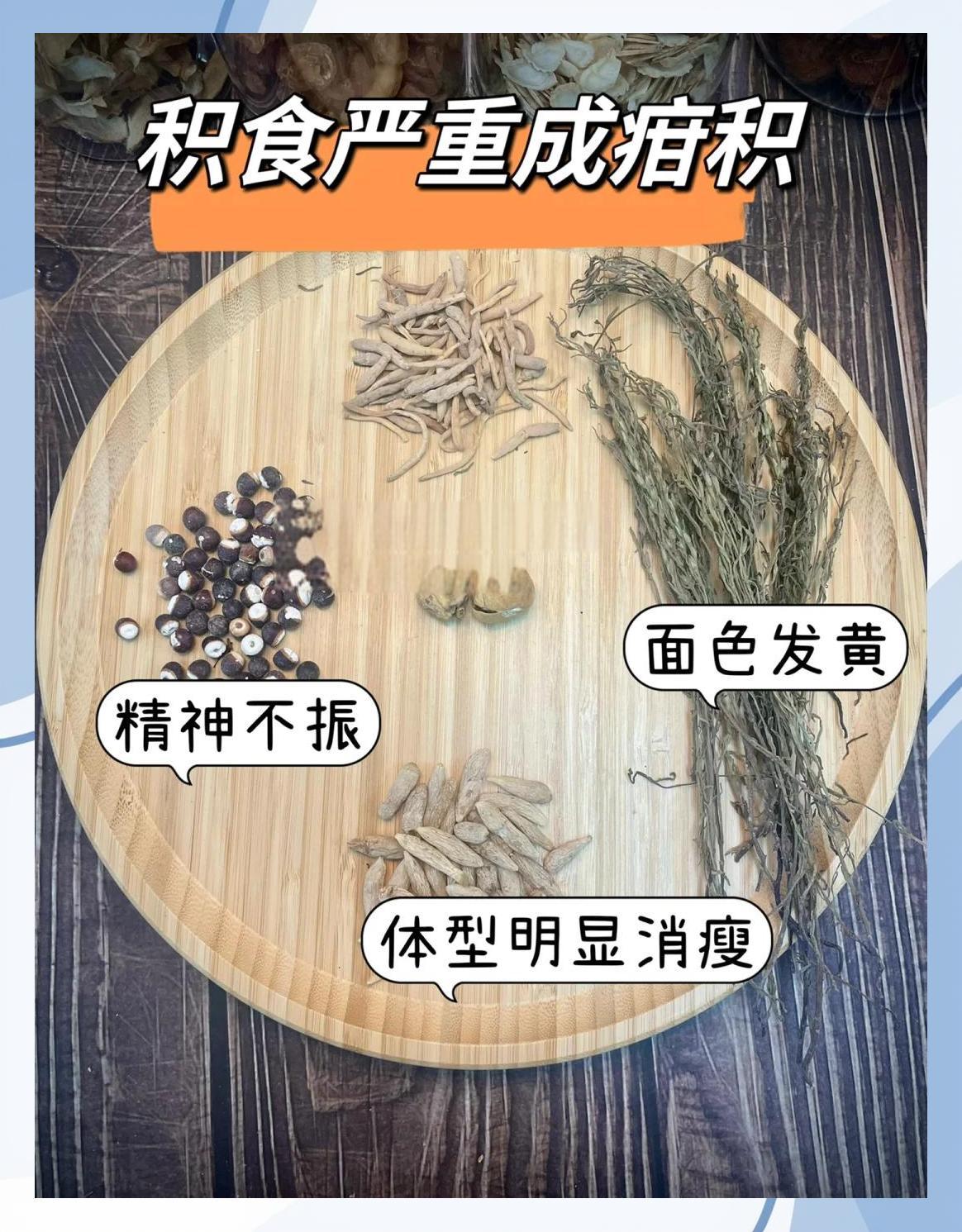 疳积与积食：儿童健康的隐形杀手