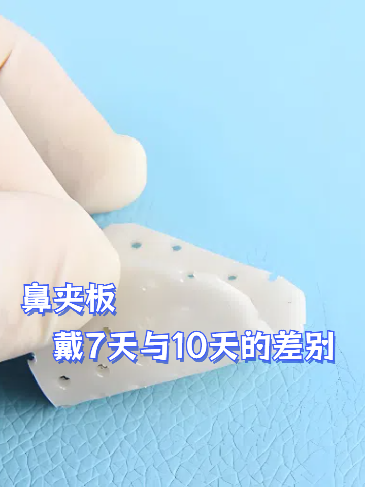 鼻夹板:戴7天与10天的差别