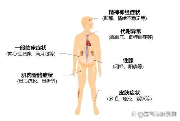 类柯兴综合征图片