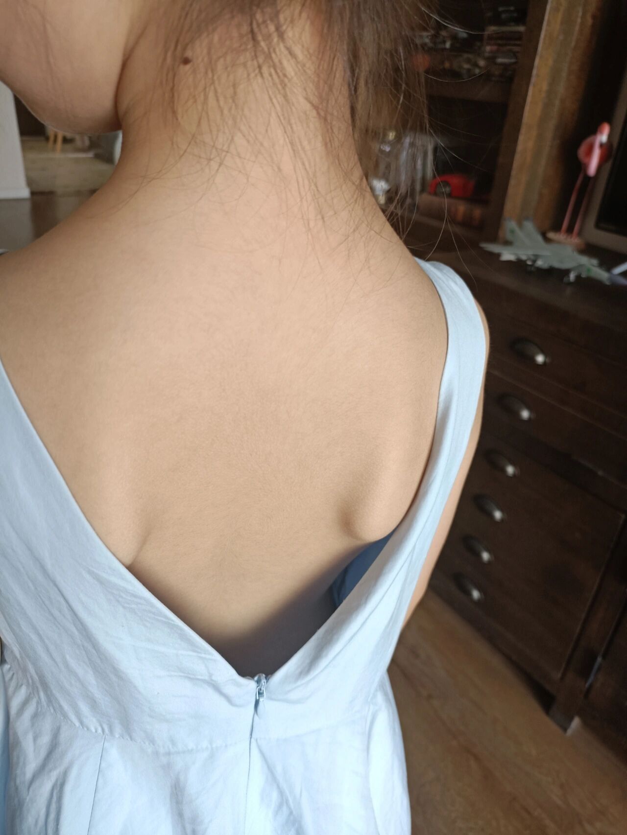 "蝴蝶骨"7岁女童