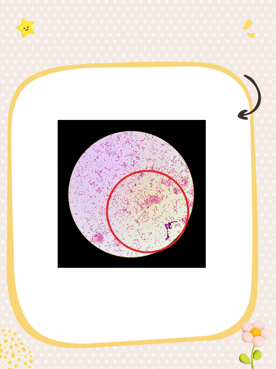 一分钟,咱们来了解淋球菌是什么疾病!