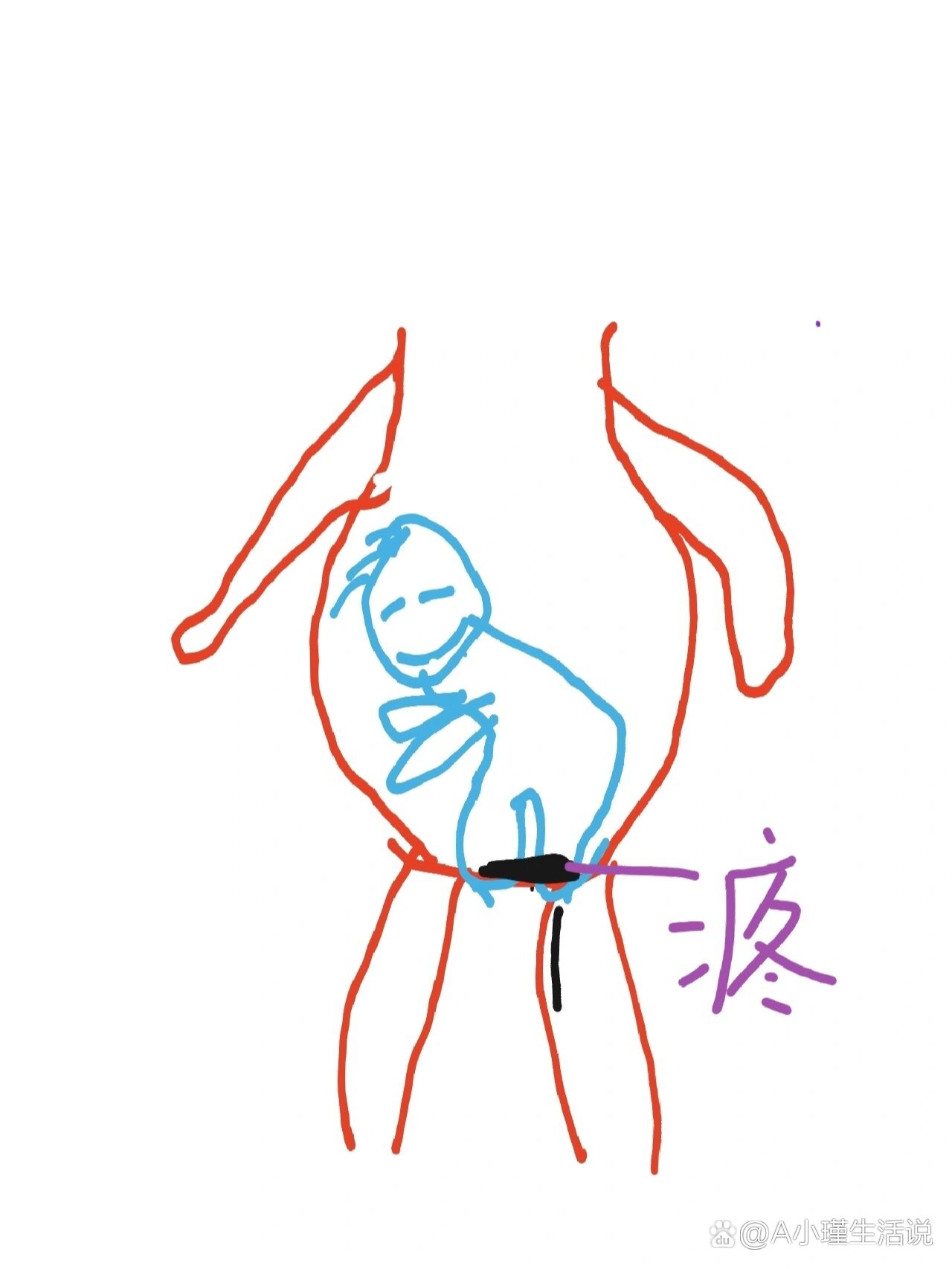 36周臀位两个月了