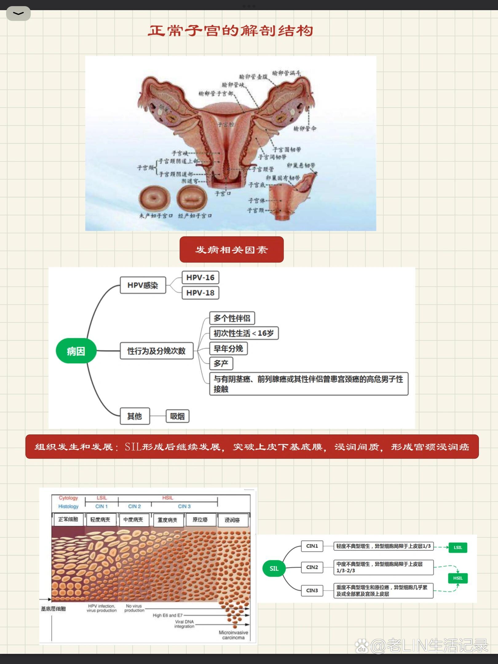 为什么会得宫颈癌图片