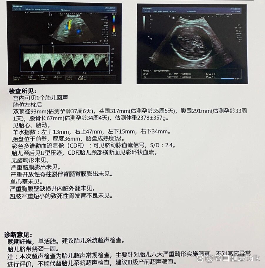 双顶径股骨大于3畸形图片