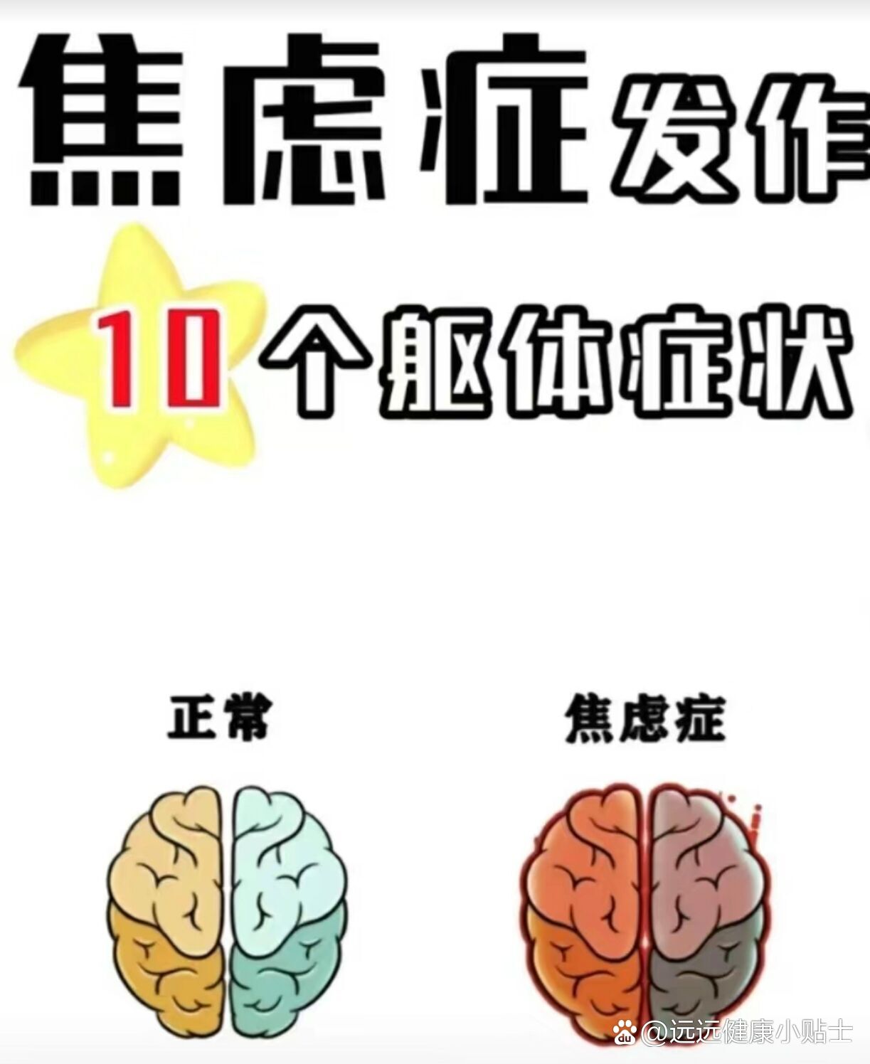 焦虑症发作的10个躯体症状