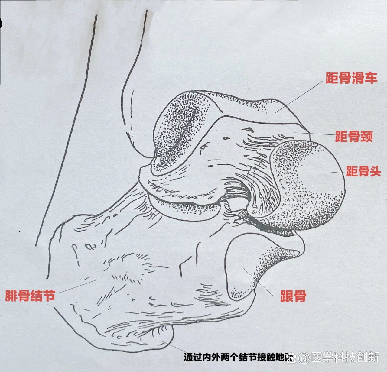 56足后部:跟骨,距骨,距跟关节/关节囊/韧带