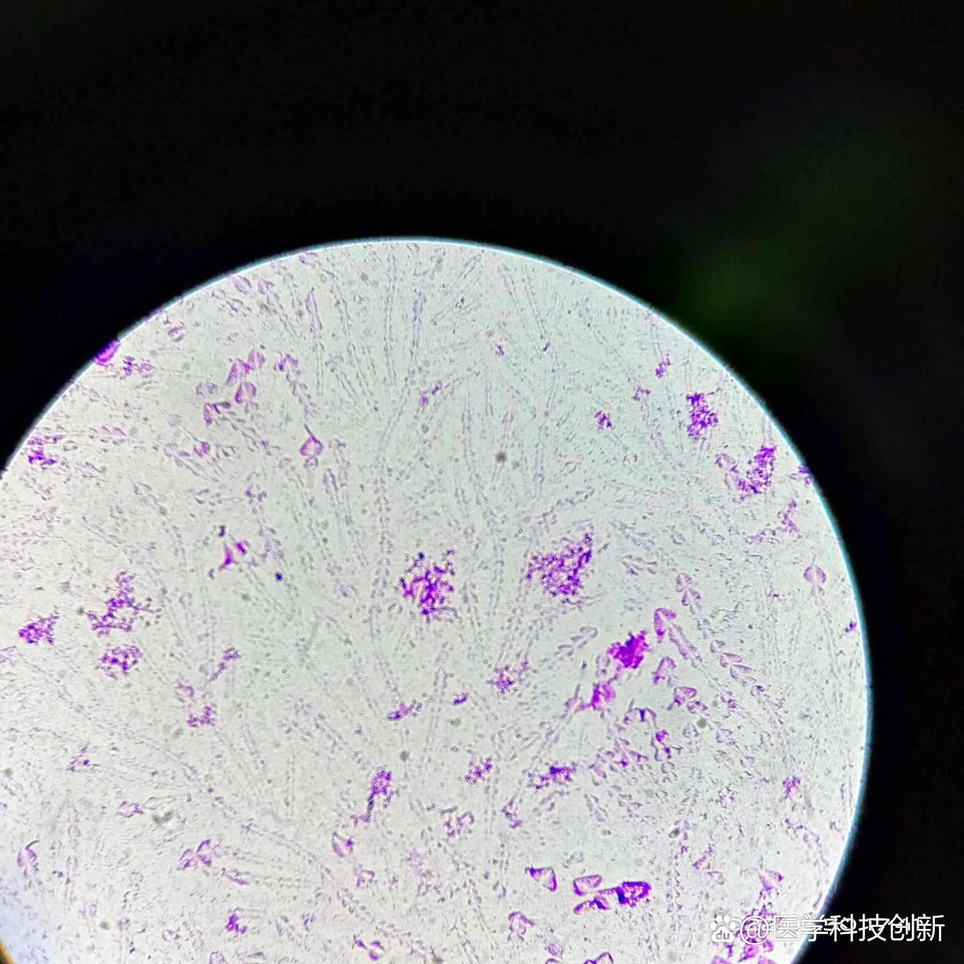 显微镜下的肠道菌群