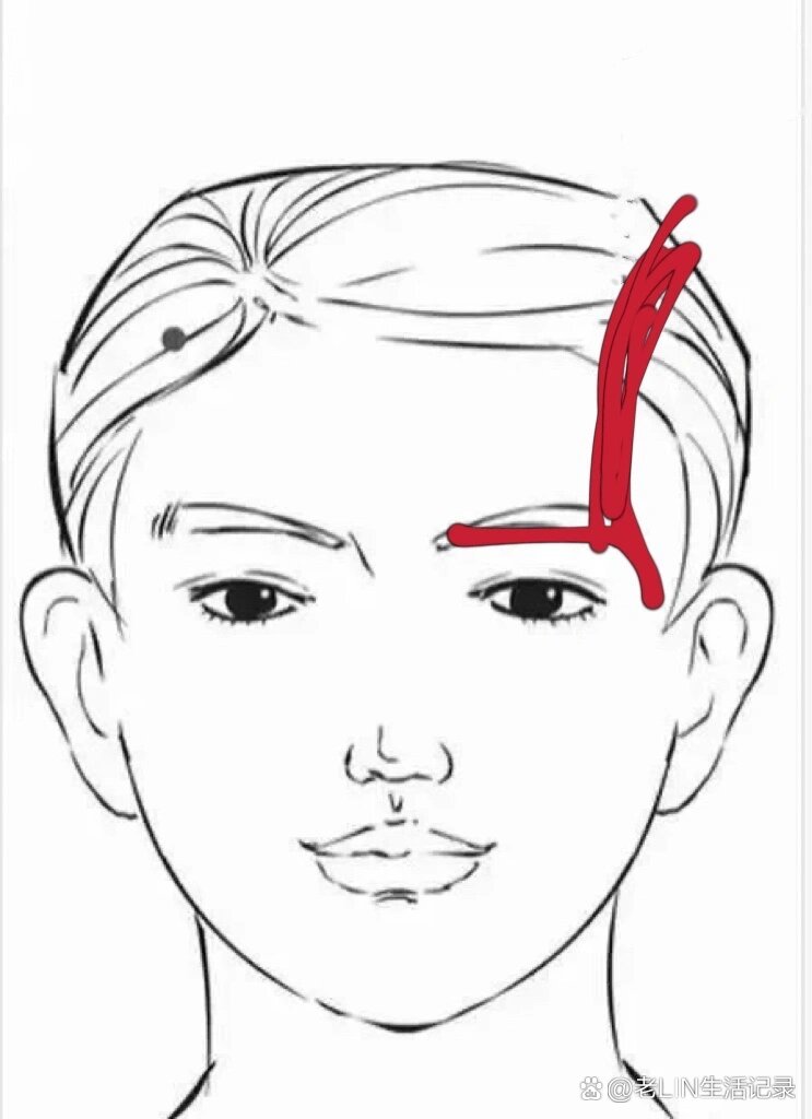 偏头痛眼睛痛咋回事?
