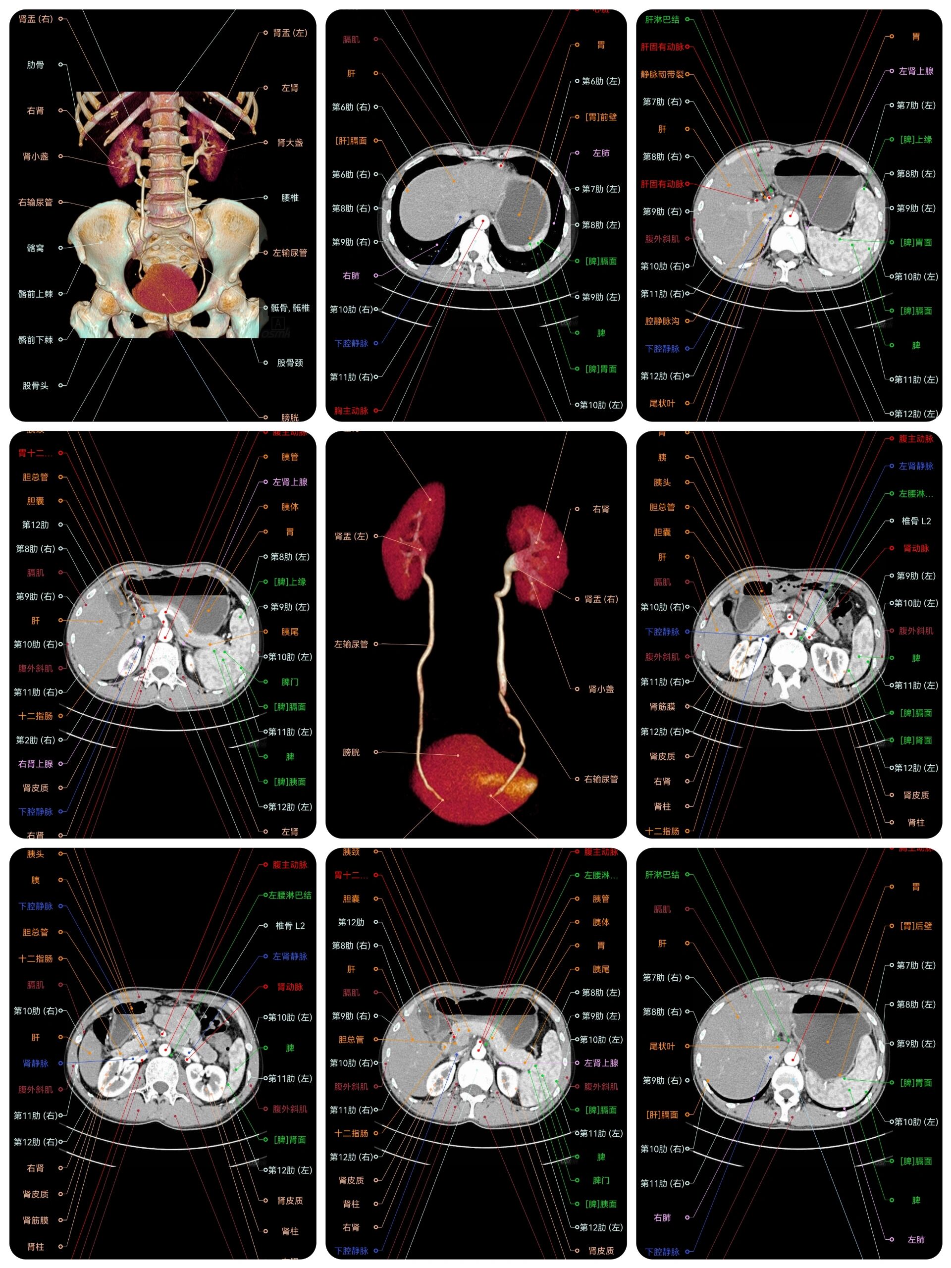 影像解剖 腹部ct断层解剖图谱