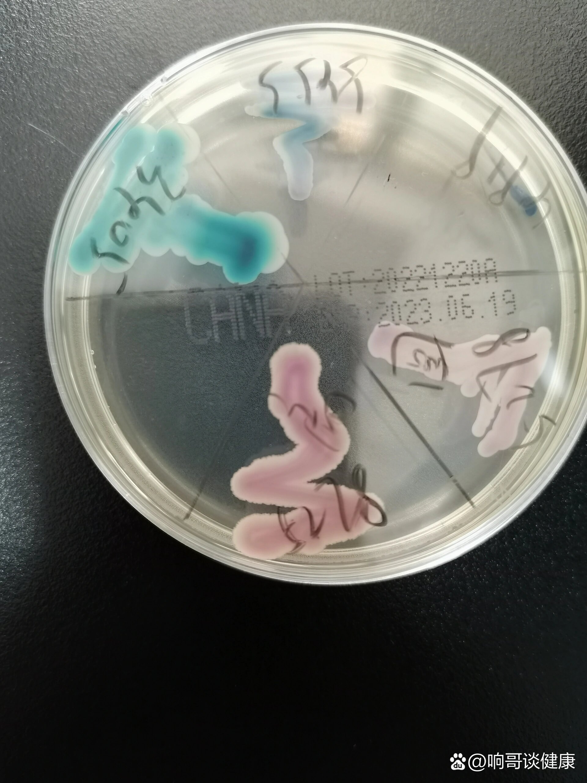 笔记22:克柔念珠菌吐温80玉米培养镜下形态