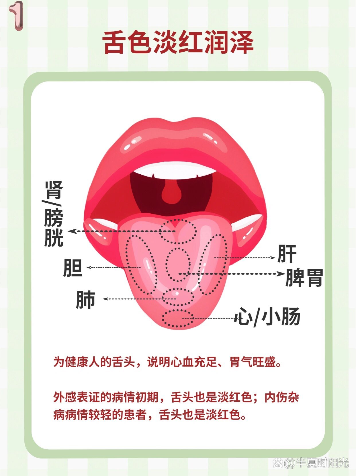 5种中医常见的舌色——观舌色,辨体质