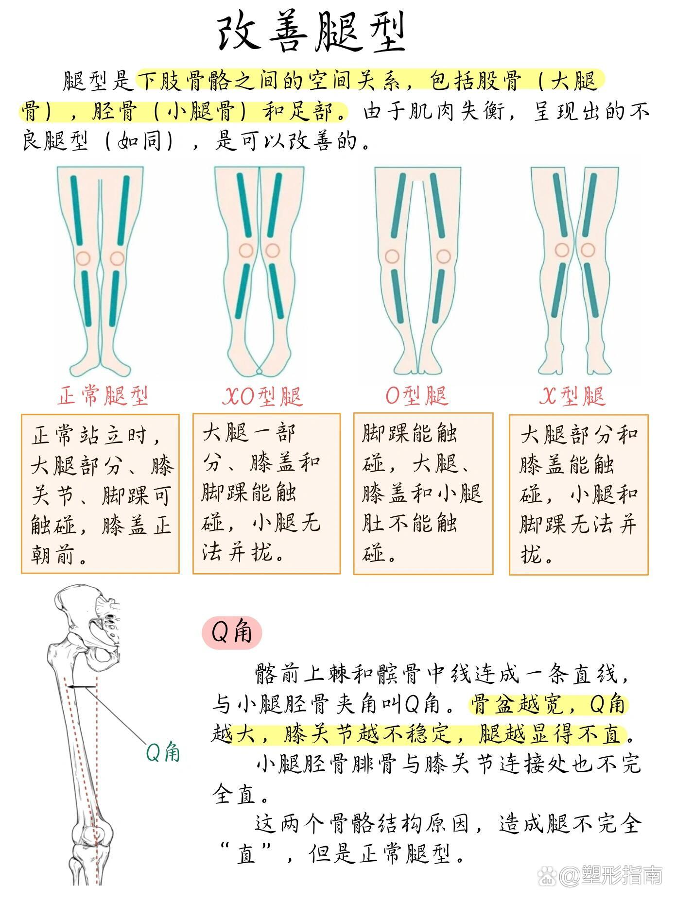 xo型腿绑腿矫正图解图片