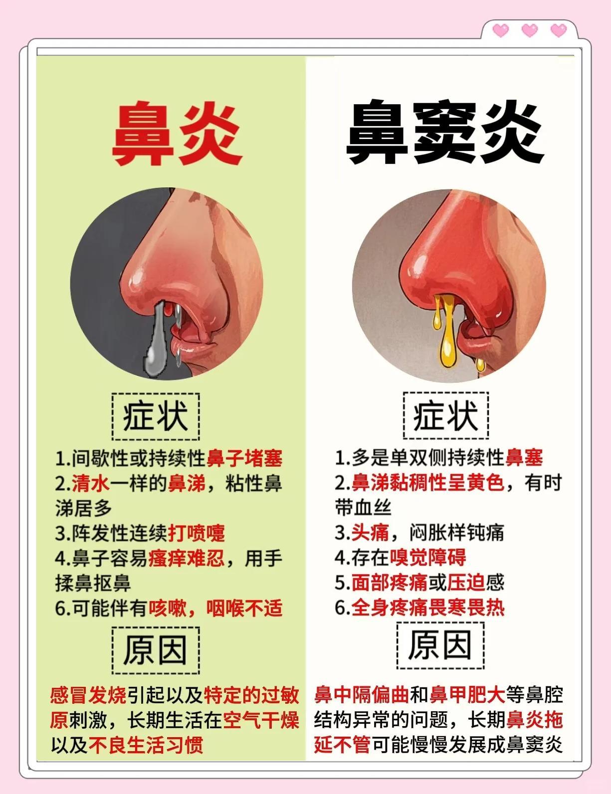鼻炎类型大揭秘！