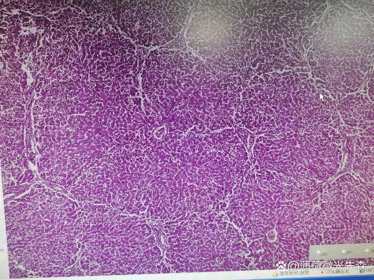 医学实验课Ⅰ病理学实验之肝细胞脂肪变
