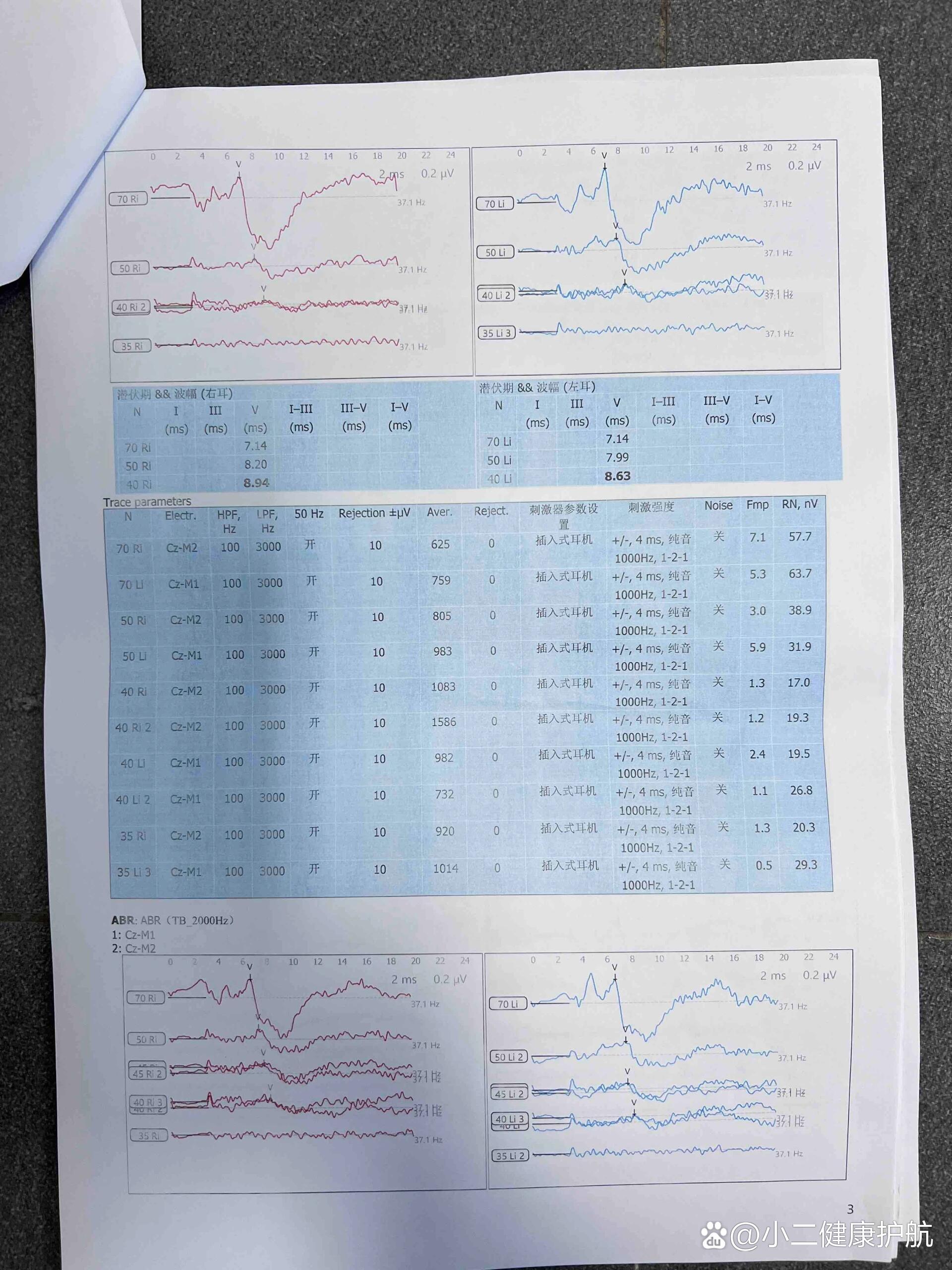 新生儿听力筛查没过怎么办?