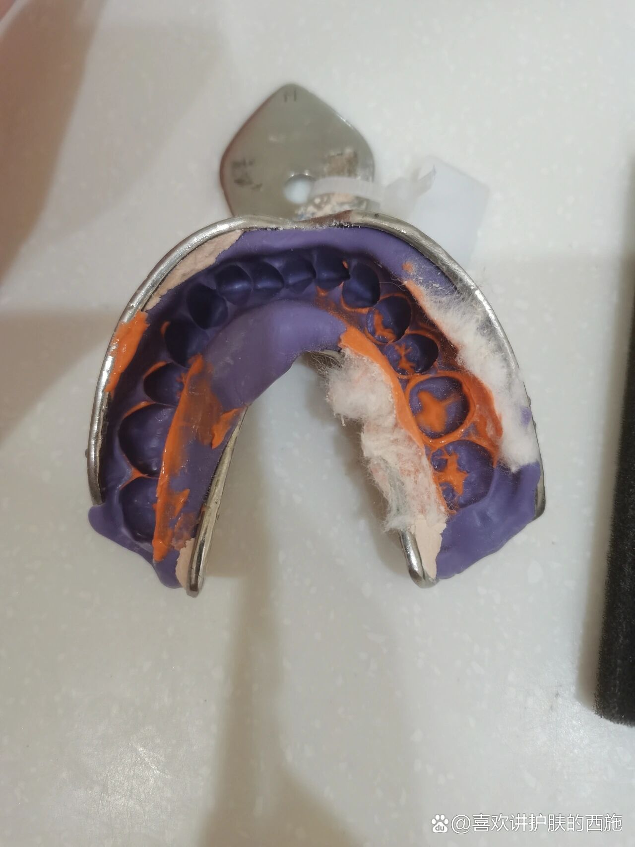 2022年全瓷牙材料价格详细表获取,全瓷牙套一颗的价格基本在1000元