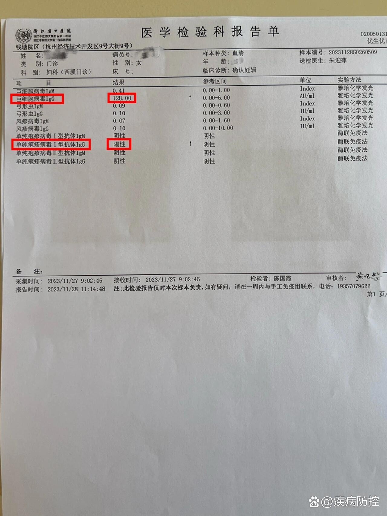 免疫球蛋白化验单图片