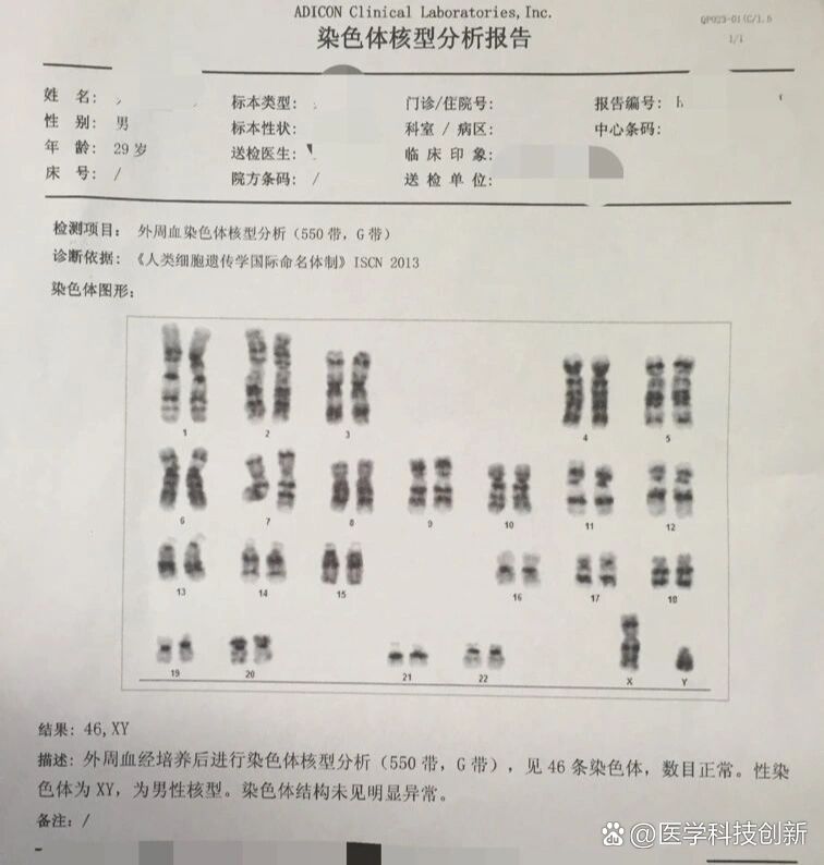 染色体核型检查