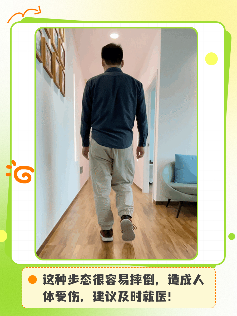 鸭步步态你见过吗?一般见于什么病?