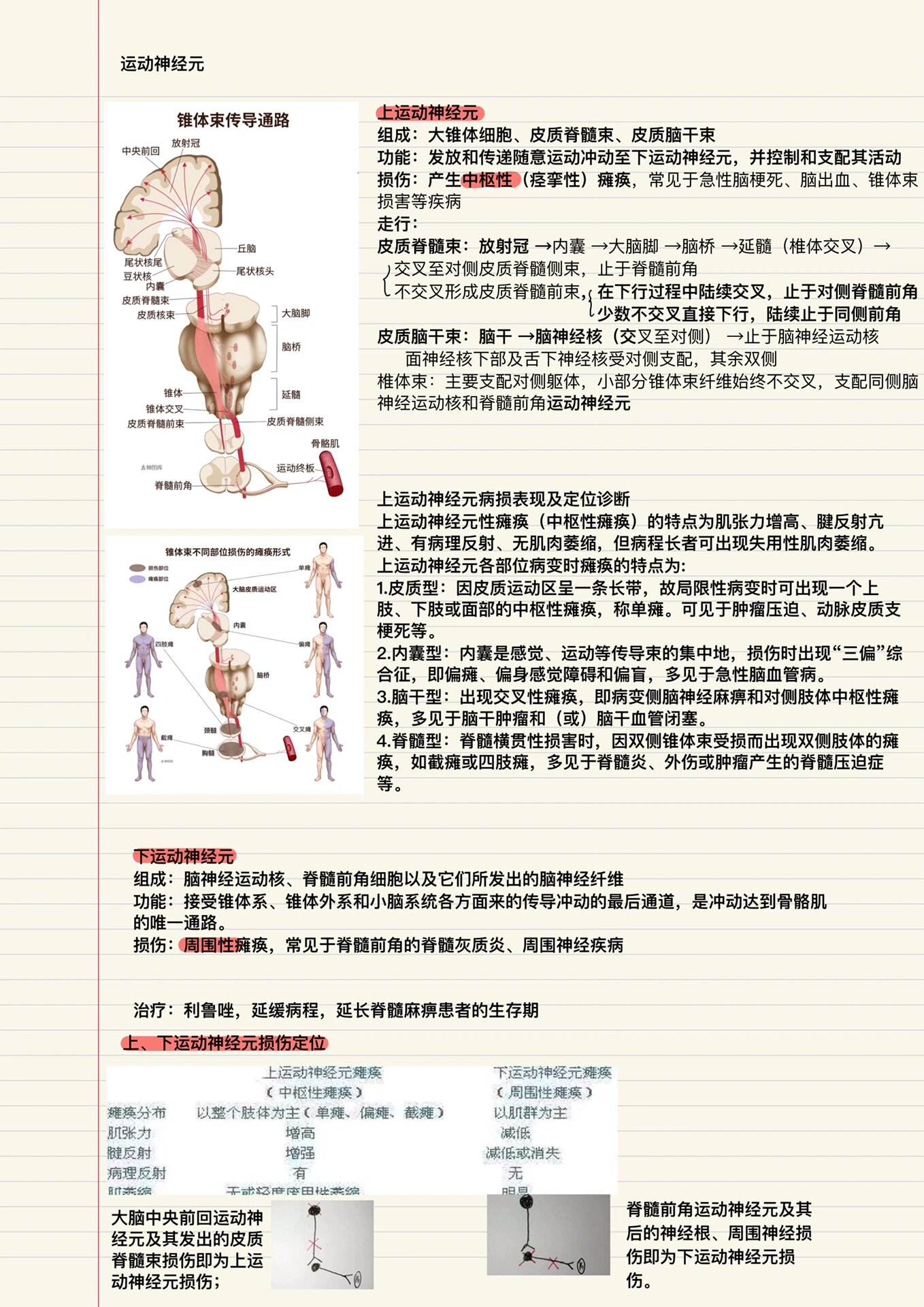 上/下运动神经元