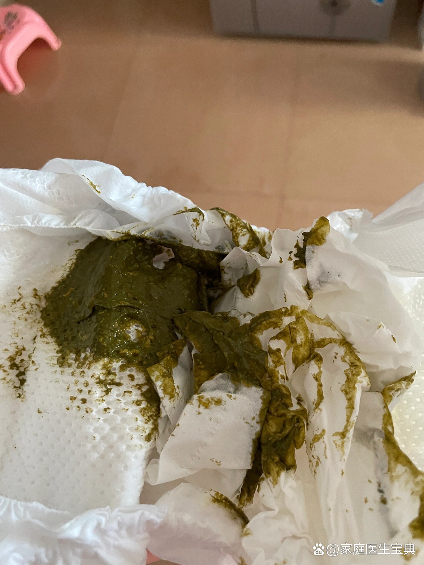 二月龄宝宝拉颗粒状绿色大便